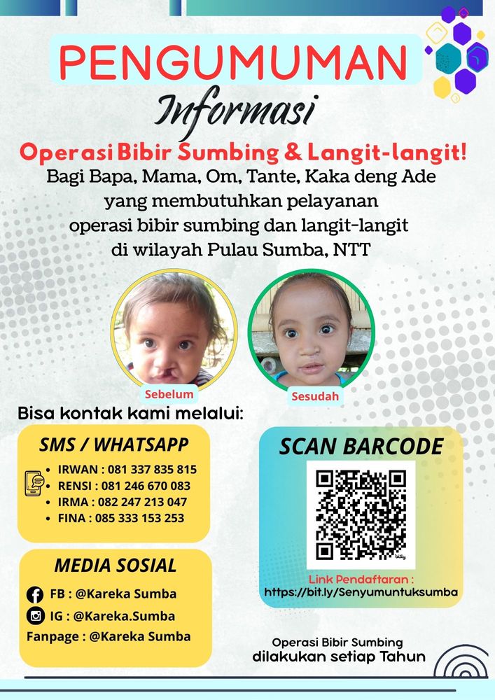 Operasi Bibir Sumbing & Langit-langit